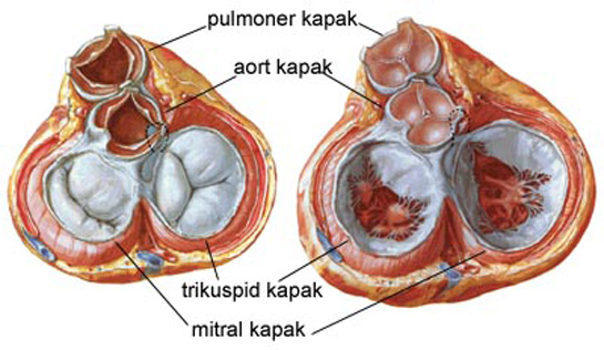 mitral kapak
